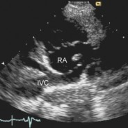 La visita cardiologica