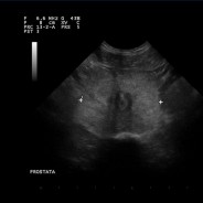 Le patologie della prostata nel cane